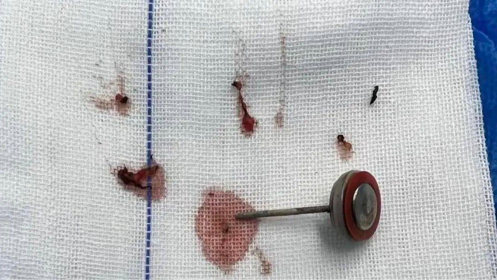 2歲孩子咬下一口瞬間爆炸！趕緊自查！很多徐州人家里都有