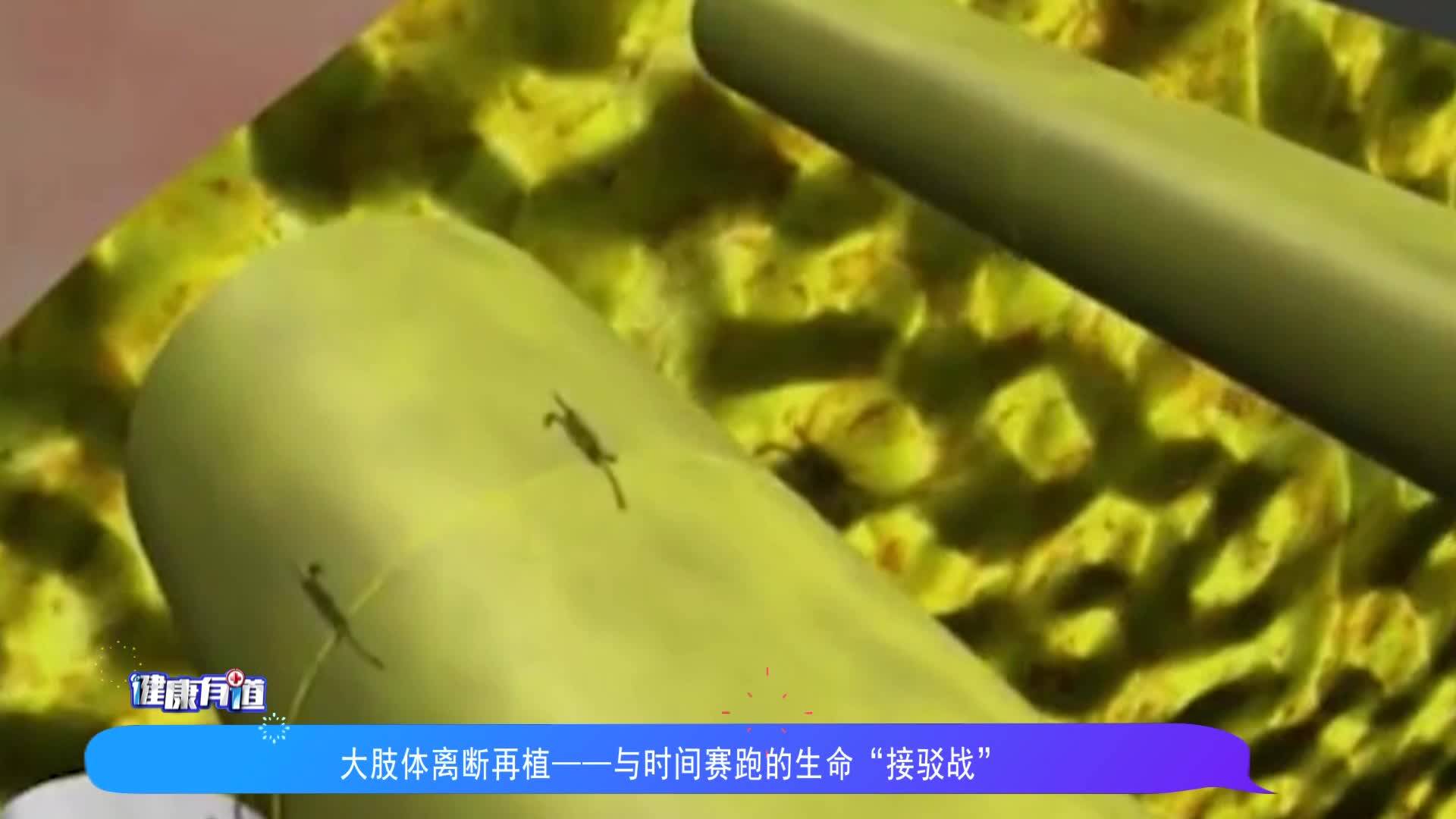 徐礦總醫(yī)院：大肢體離斷再植&mdash;&mdash;與時(shí)間賽跑的生命&ldquo;接駁戰(zhàn)&rdquo;