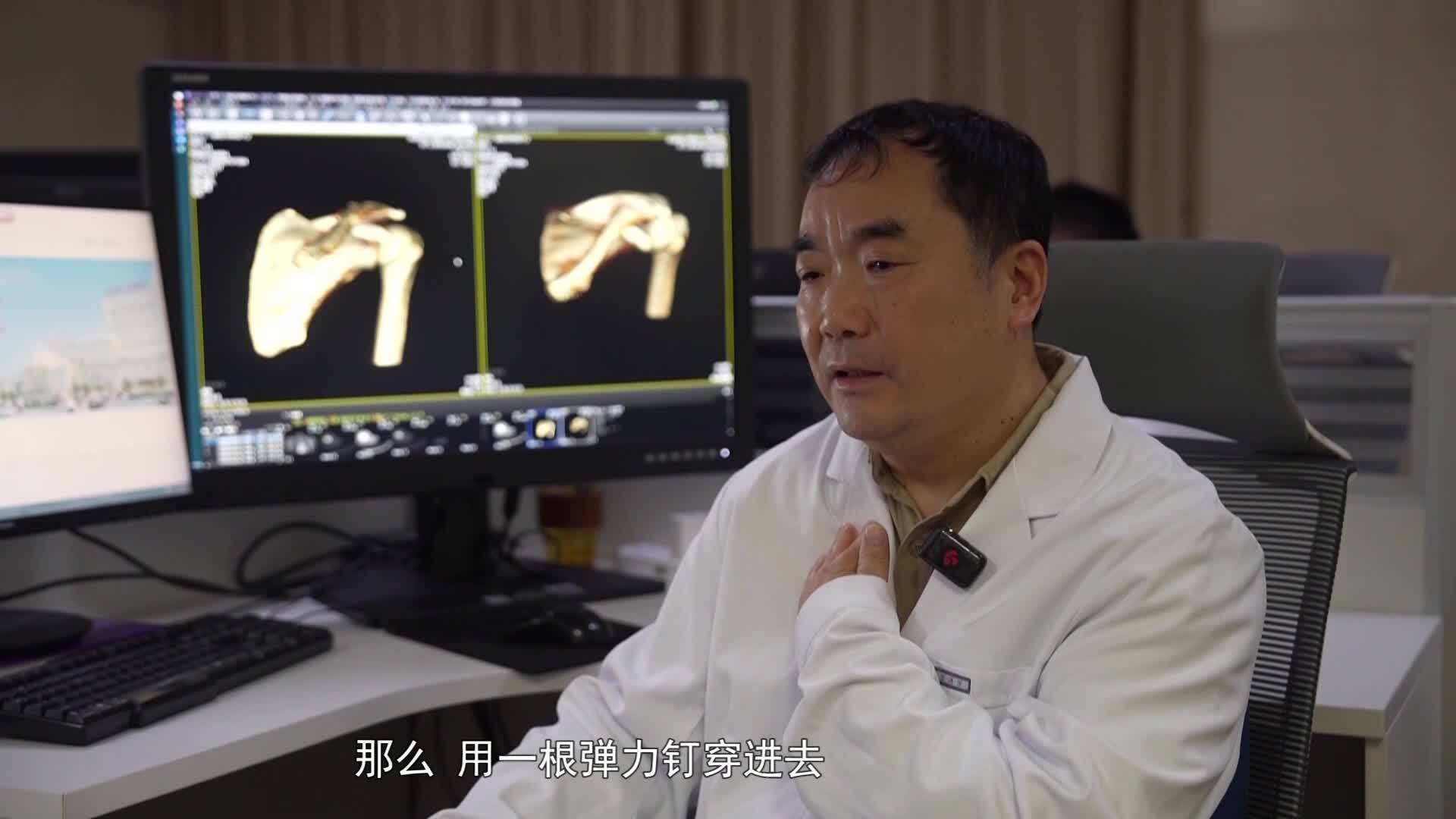 徐州仁慈醫院：創新手術助力高明宇左肩鎖骨骨折快速康復